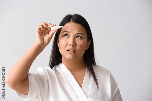 Portrait of young Asian woman with remedy for acne on white background