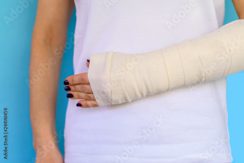 Woman with broken arm bone in cast, plastered hand on blue background. © Inna