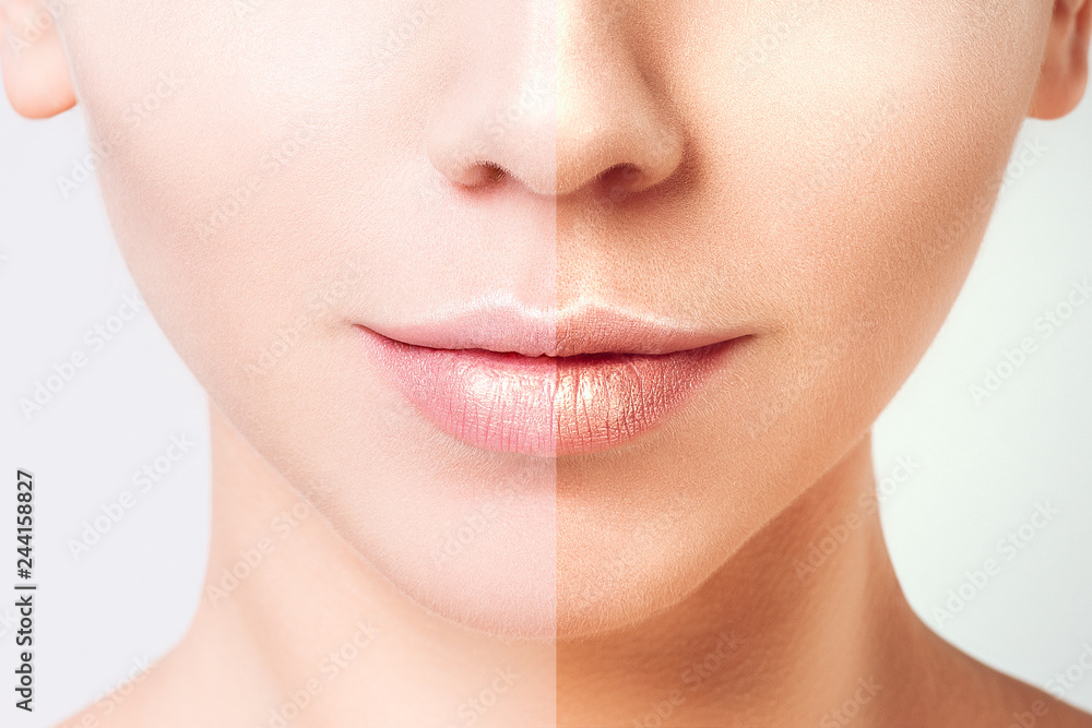 Woman face portrait with half tan skin. Beauty Portrait. Beautiful Spa model Girl with Perfect Fresh Clean Skin. Youth and Skin Care Concept. Woman face portrait with half tan skin. Beauty Portrait. Beautiful Spa model Girl with Perfect Fresh Clean Skin. Youth and Skin Care Concept.