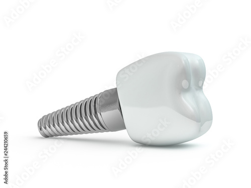 Dental implant dentist, tooth layout, plastics, man, teeth, treatment. 3D