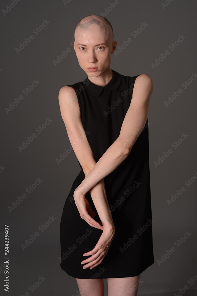 bald girl posing in Studio in black dress bald girl posing in Studio in black dress