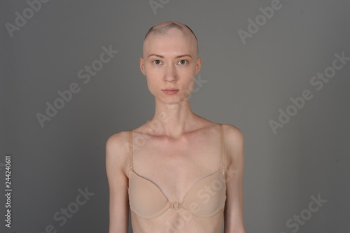 bald girl in beige lingerie posing on grey background