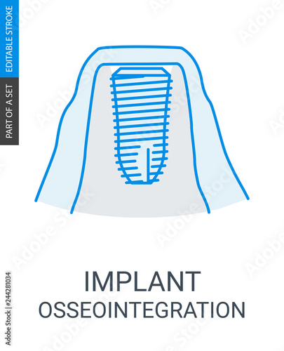 Dental implant Vector Icon.