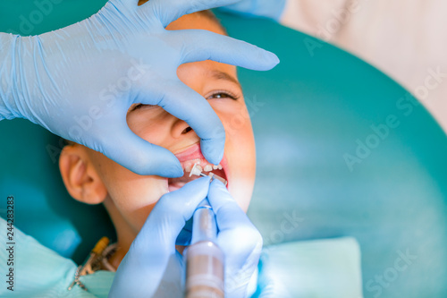 Dentist is treating a boy's teeth. Dentist examining boy's teeth in clinic. A small patient in the dental chair smiles. Dantist treats teeth.