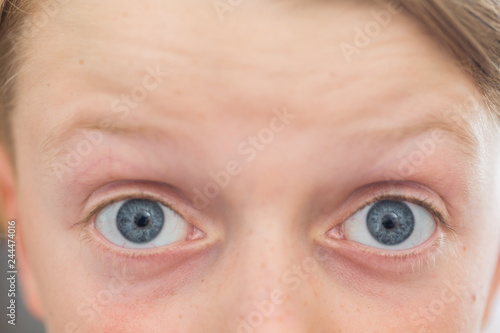 close up of an 8 year old's blue eyes with surprised or shocked expression
