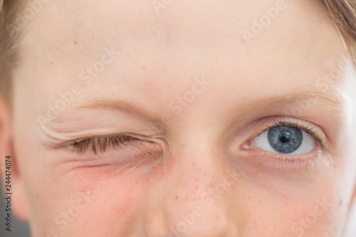 close up of an 8 year old's blue eyes with one eye closed winking