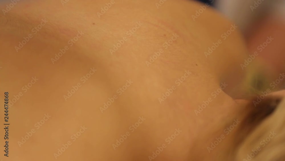 Do laser epilation of the face, neck and back of the patient Do laser epilation of the face, neck and back of the patient