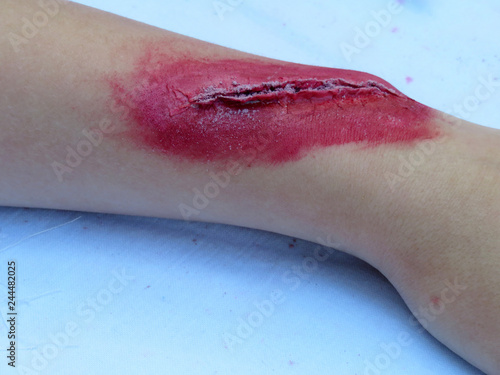 Heavy wound on a human hand. Bloody wound makeup special effect