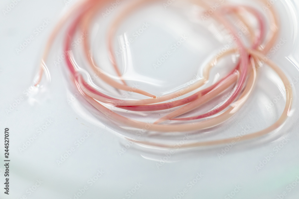 Ascariasis is a disease caused by the parasitic roundworm Ascaris ...