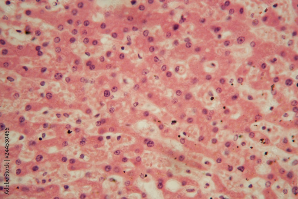 Liver Cells Under The Microscope Can You Label Them - hz88s6m