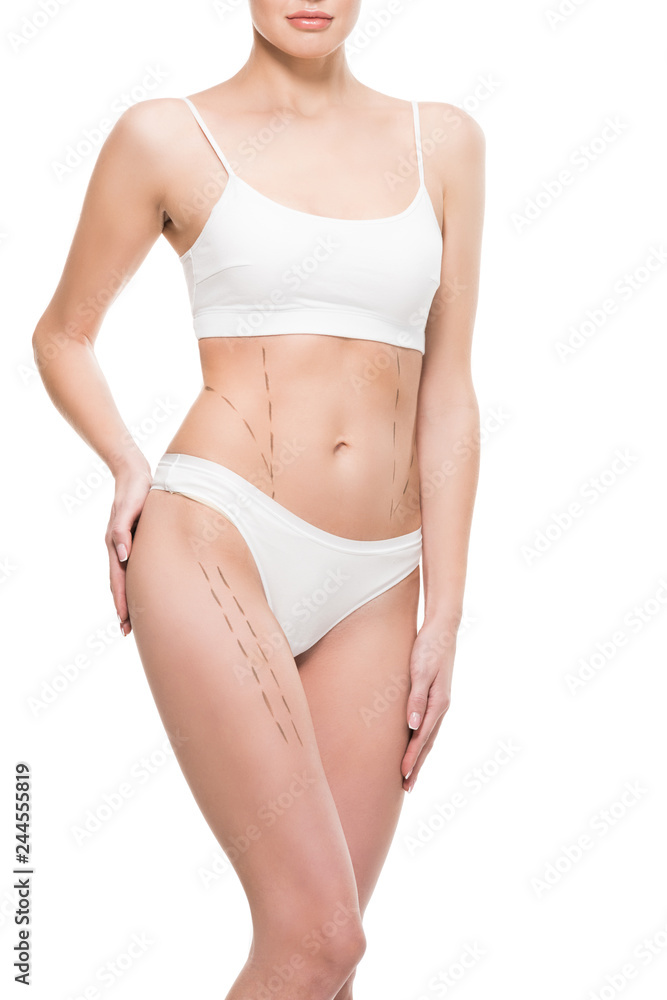 cropped shot of young woman in white underwear with correction marks on body isolated on white cropped shot of young woman in white underwear with correction marks on body isolated on white