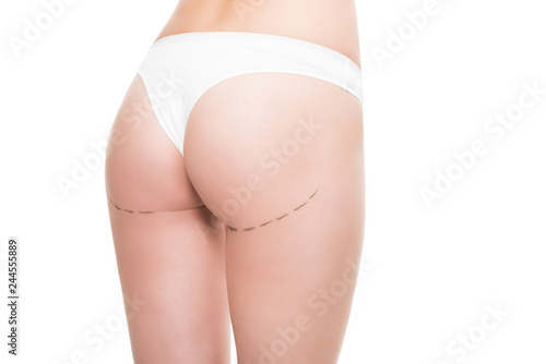 cropped shot of female buttocks with correction marks isolated on white