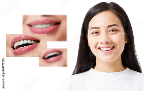 Collage of healthy smiling people. Beautiful asian young woman with white veneers and perfect smile. Tooth care dental medicine. Isolated and copy space.