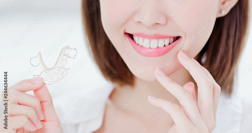 woman with retainer for teeth - obrazy, fototapety, plakaty 