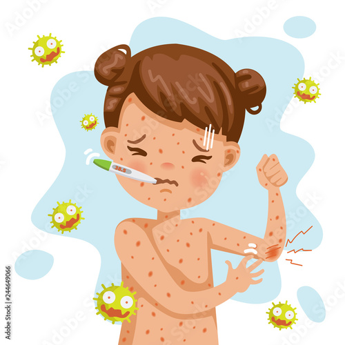 German 
Rash fever of rubella. A sick little girl with fever and red rash. Gel reduces heat. Feeling bad when symptoms. Cartoons of rubella virus. Cause of infection. photo