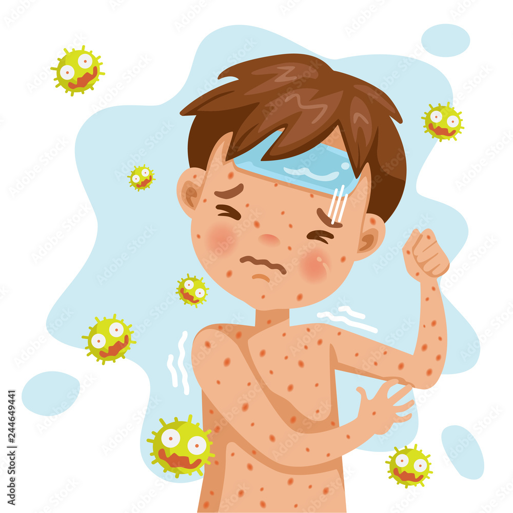 Vetor De Rubella Rash Fever German Measles A Sick Boy With Fever And vetor-de-rubella-rash-fever-german-measles-a-sick-boy-with-fever-and