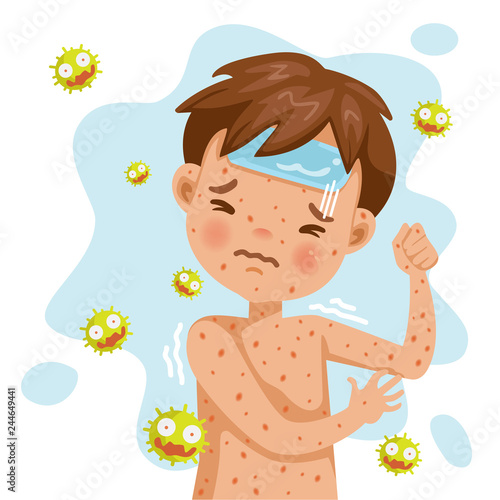Rubella 
Rash fever. German measles. A sick boy with fever and red rash. Gel reduces heat. Feeling bad when symptoms. Cartoons of rubella virus. Cause of infection.