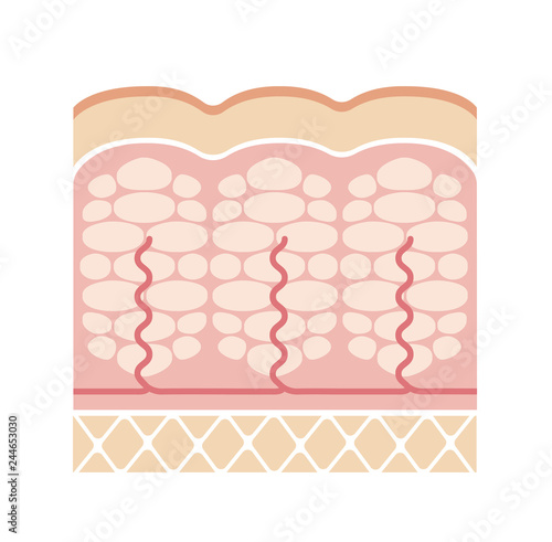 Cellulite's skin illustration ( No text )