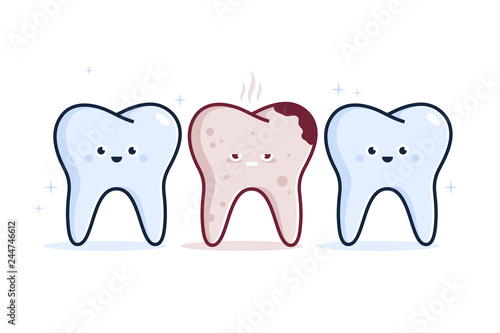 Illustration of Healthy teeth and diseased teeth