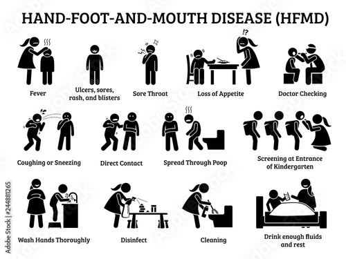 Hand foot and mouth disease HFMD icons. Illustrations depict signs, symptoms, prevention, and actions on HFMD viral infection for small children at preschool, school and daycare. photo