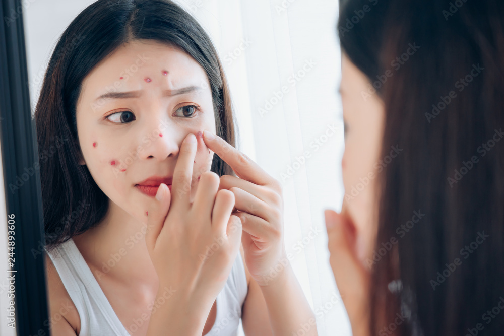 Young Asian woman squeeze acne problem face looking at mirror her without Skincare.
