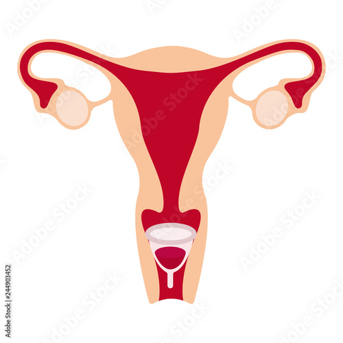 Menstrual cup in use, female period hygiene product in uterus. Vector illustration isolated on white.