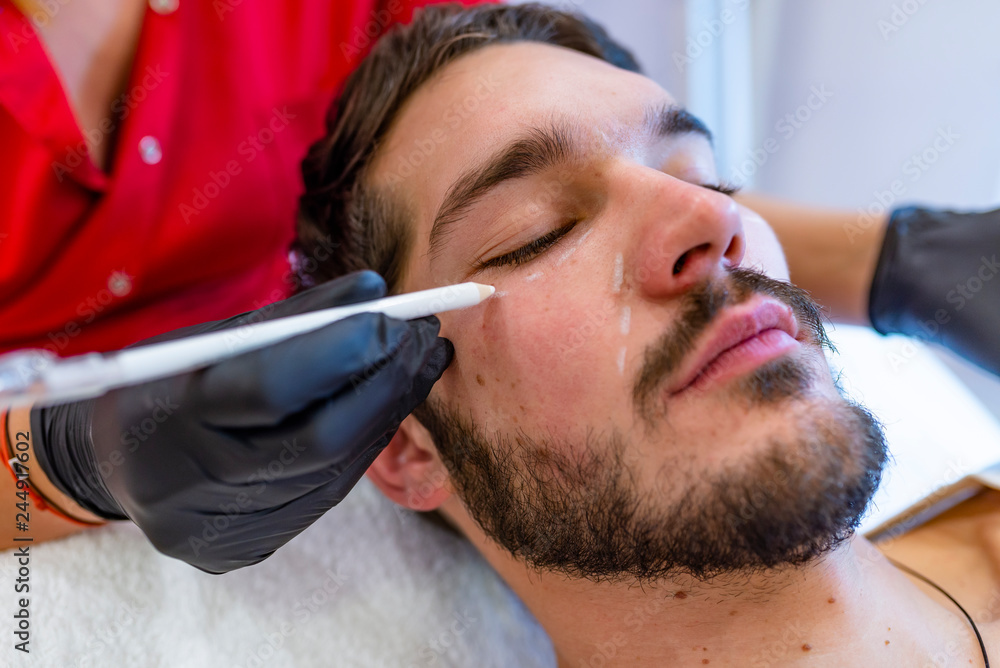Fototapeta premium Happy male patient with correction lines on the face in an examination room.