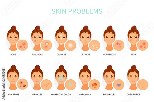 Skin problems vector photo