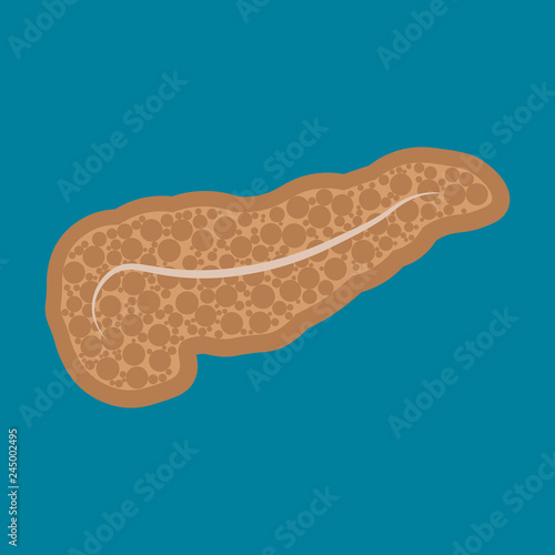 Diseases of the pancreas. Pancreatitis. dysbiosis, nausea, vomiting, belching
