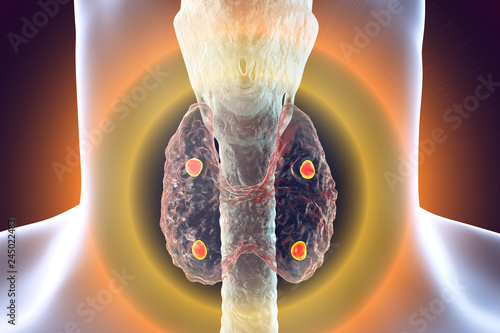 Parathyroid glands anatomy photo