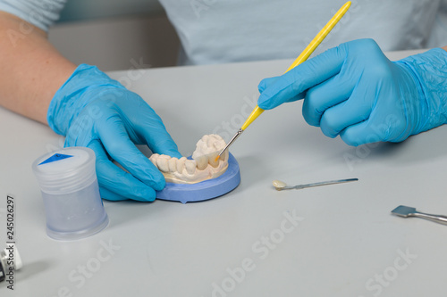 Zahnersatz wird im Zahnlabor farblich angeglichen