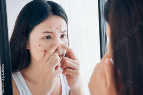 Young Asian woman squeeze acne problem face looking at mirror her without Skincare.
