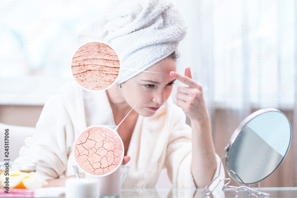 Beautiful young woman looking at her dry skin with cracks and with first wrinkles Beautiful young woman looking at her dry skin with cracks and with first wrinkles