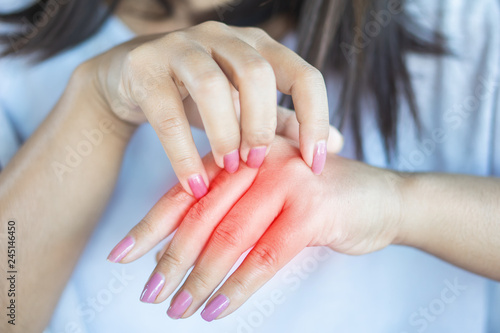 closeup woman having itchy and  scratching hand  healthcare and medical concept 