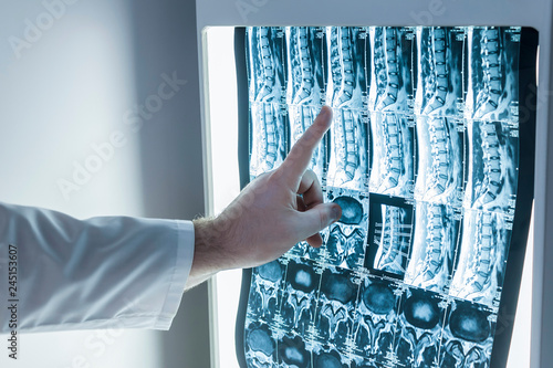 Neurologist and surgeon examine a patient's spine image