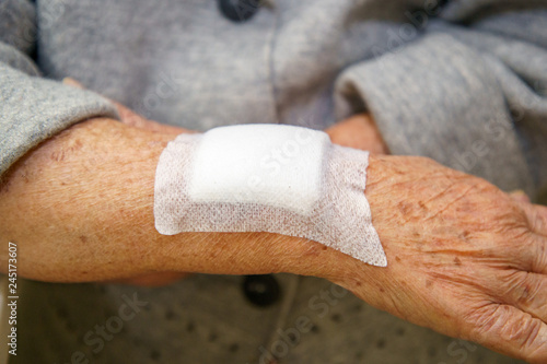Close up old woman hand or arm to the wounded waiting for nurse treatment.