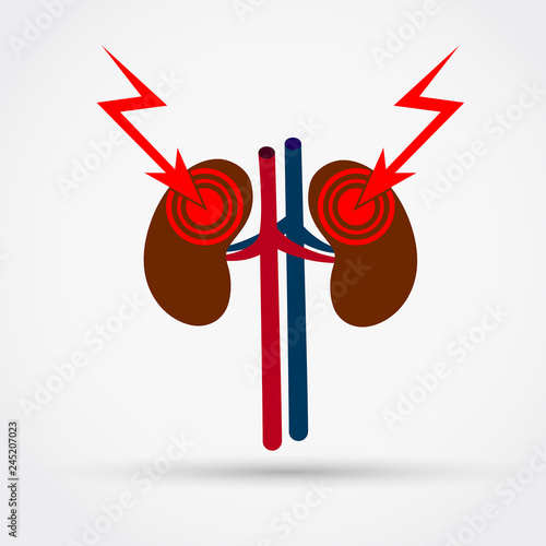 Kidneys pain vector illustration