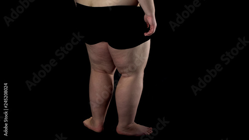 Back view to overweight male legs on dark background, problems, insecurities