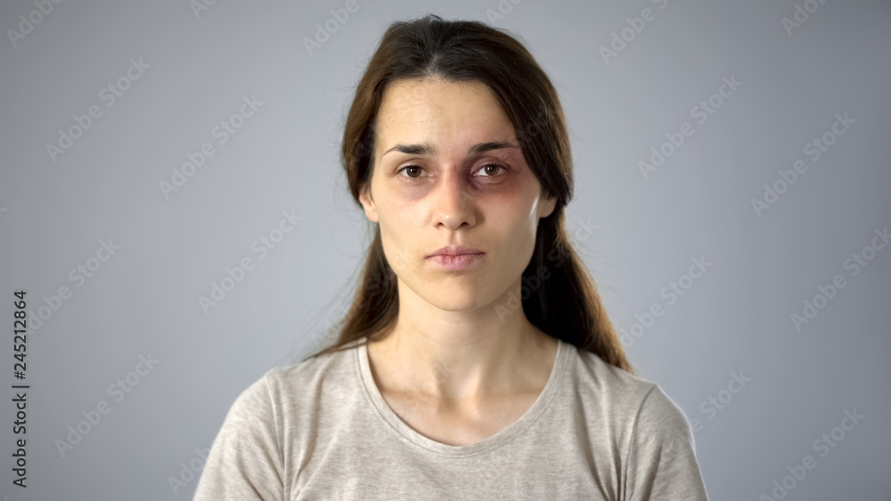 Portrait of bruised woman looking at camera, domestic violence victim, awareness Portrait of bruised woman looking at camera, domestic violence victim, awareness