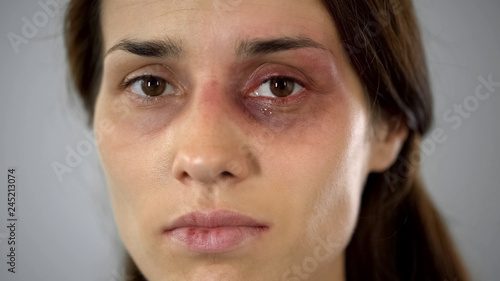 Hurt lady crying, bruised face close-up, domestic violence issue, awareness