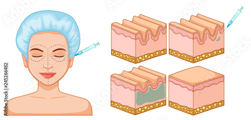 Lady facial and skin botox
