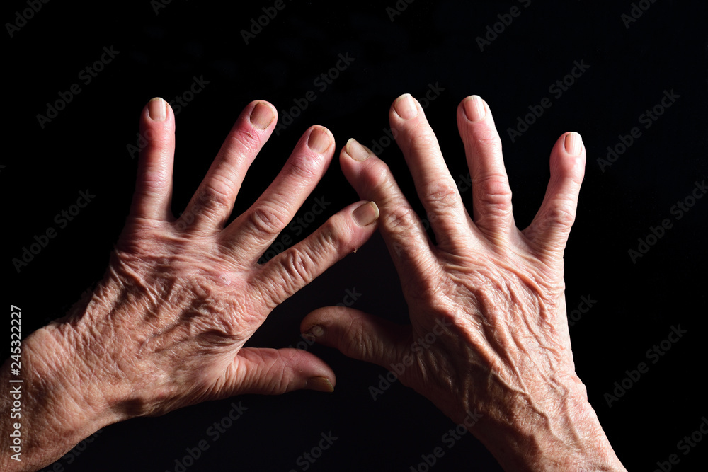 hands of elderly woman