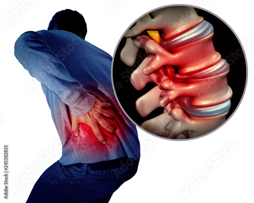 Schilderij op canvas Lower Back Pain