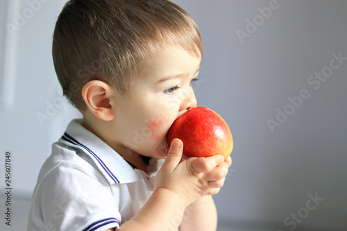 Close up portrait of cute little baby boy with atopic dermatitis on his cheek holding and eating red apple. Food allergy photo