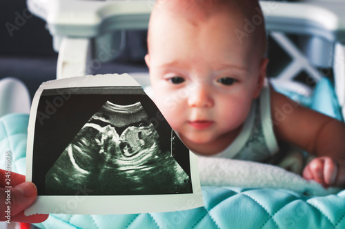 Ultrasound image at the 20th week of pregnancy in the foreground. In the background is a 6 month old baby. Before and now. Selective focus.