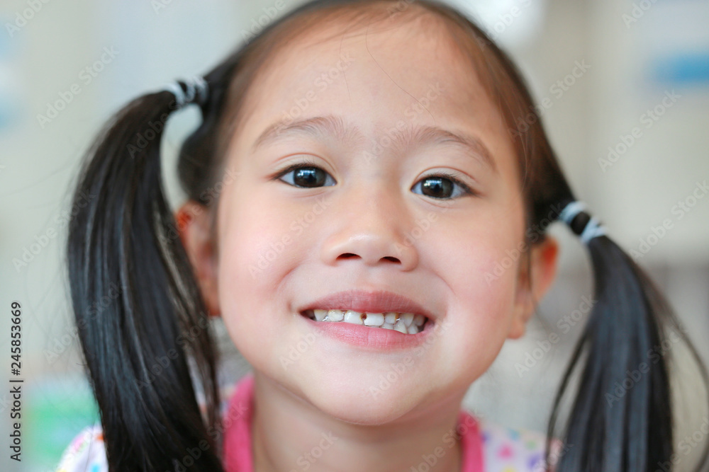 Close-up little girl with a teeth broken and rotten. Close-up little girl with a teeth broken and rotten.