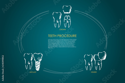 Teeth procedure - crown, veneer, implant vector concept set