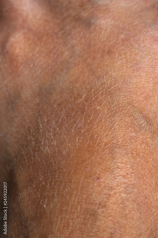Woman's dry skin on foot, Close up & Macro shot, Selective focus, Asian Body skin part, Healthcare concept, Abstract background Woman's dry skin on foot, Close up & Macro shot, Selective focus, Asian Body skin part, Healthcare concept, Abstract background