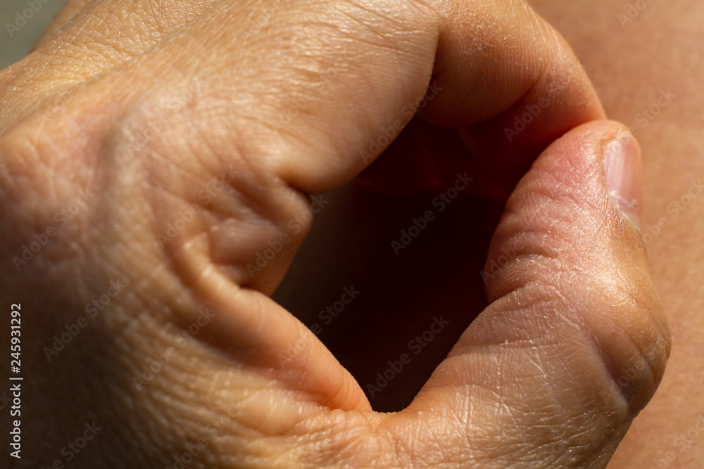 Fototapeta premium Woman's dry skin on thumb of hand, Close up & Macro shot, Asian Body skin part, Healthcare concept, Abstract background