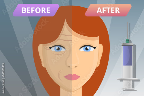 Woman face before after lifting concept banner. Cartoon illustration of woman face before after lifting vector concept banner for web design